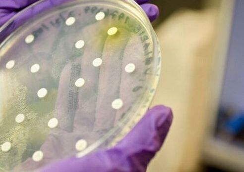 Prostatit tanısı için bakteri kültürü