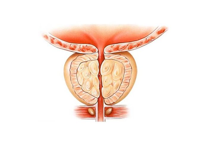 halk ilaçları ile prostatit tedavisi